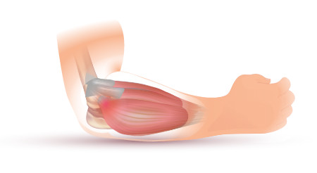 We have highly trained experts ready to look at your elbow pain